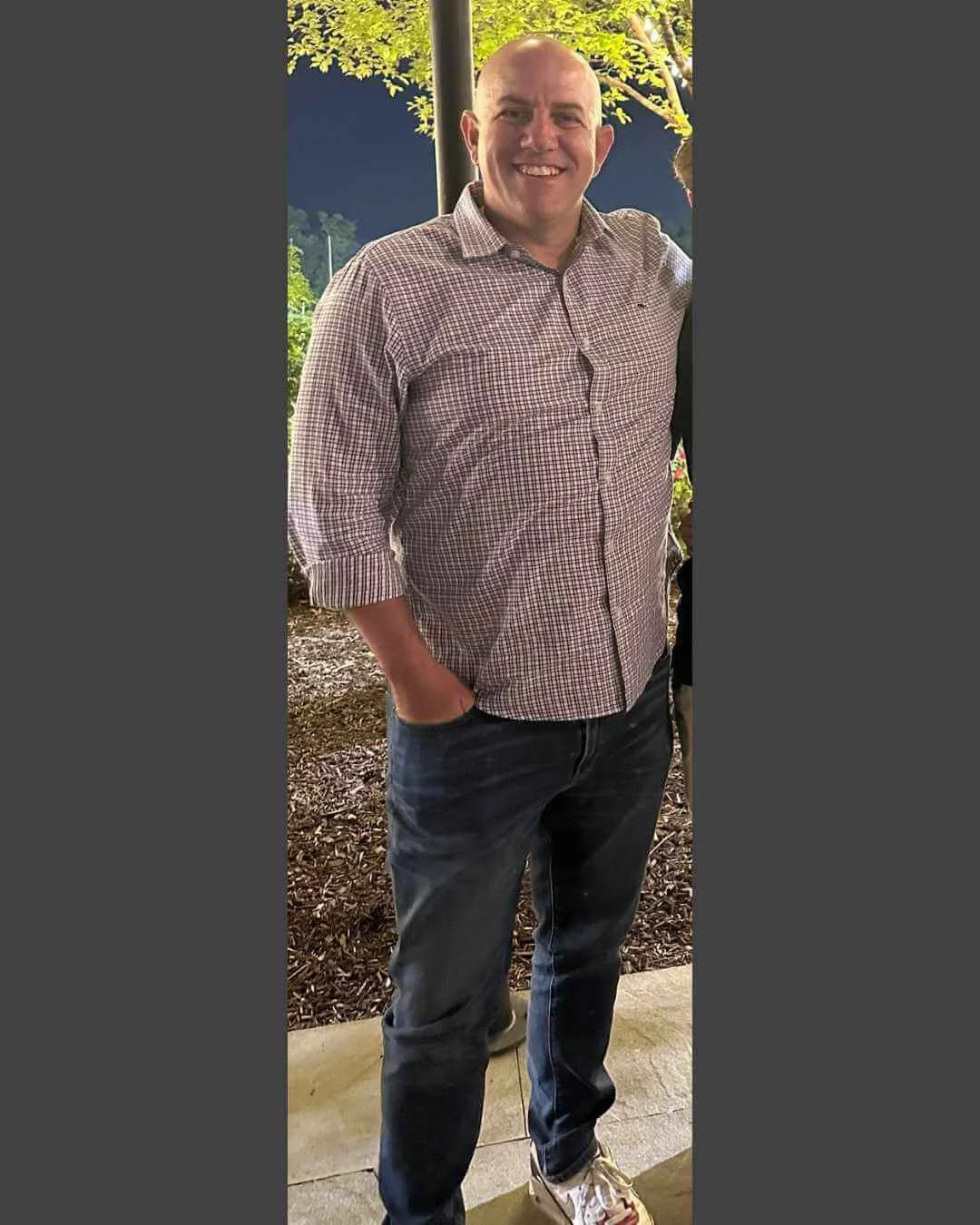 Before: 52 lb weight loss patient