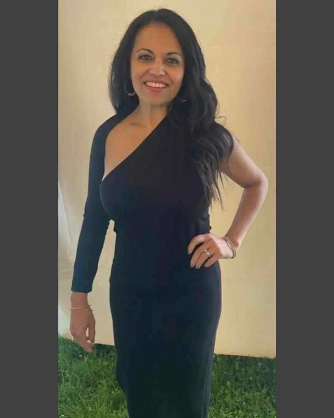 After: 20 lb weight loss patient